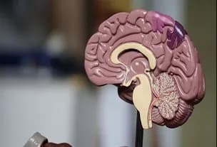 Anatomical model of a brain