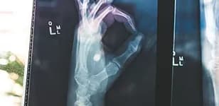 X-ray of a hand on a light box